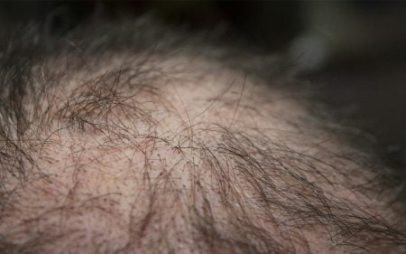 petua merawat rambut gugur
