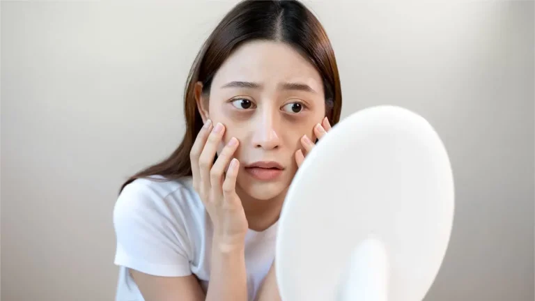 Muka Bengkak (Puffy Face): Punca, Pencegahan dan Petua